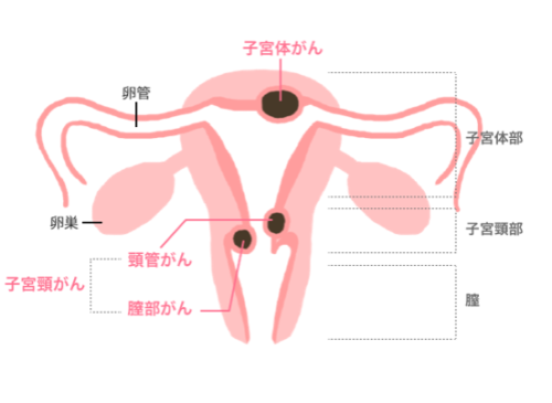 【女性の病気】更年期「不正出血」は検査を。子宮体がんの可能性も。 kintaの毎日のつぶやき